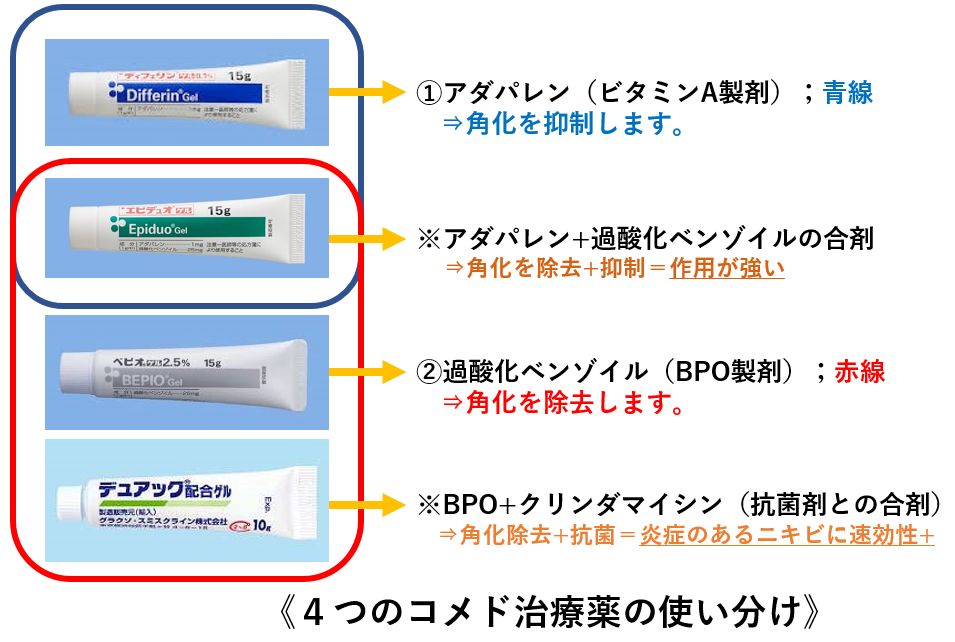 治療 しこり ニキビ