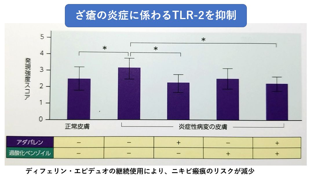 ニキビ瘢痕のリスク減少