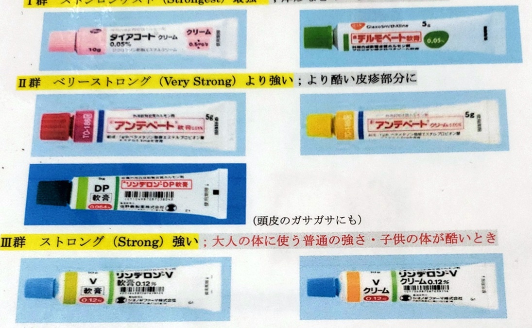 異汗性湿疹を発症するリスクがあるのは誰ですか?