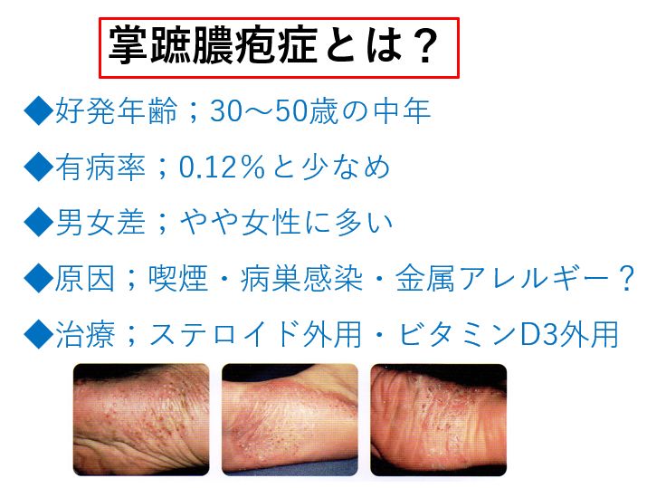 掌蹠膿疱症｜大森・大木皮膚科【治し方・やってはいけないことは？】