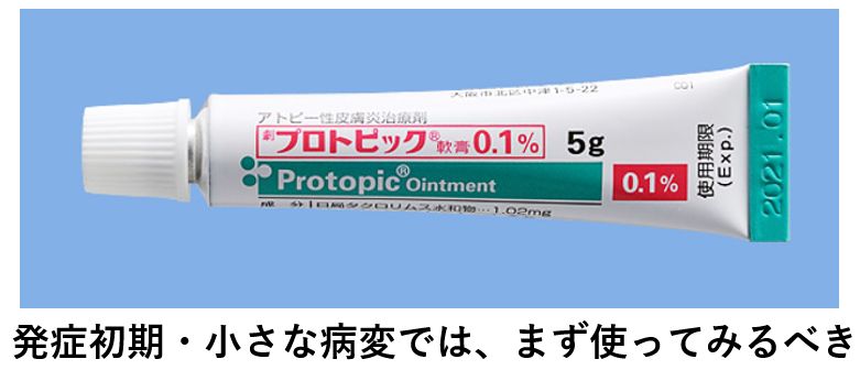 白斑 大田区大森の大木皮膚科 原因と治し方 白斑治療を詳しく解説