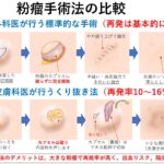 粉瘤・くり抜き法のデメリットを詳しく解説|大田区大森・大木皮膚科