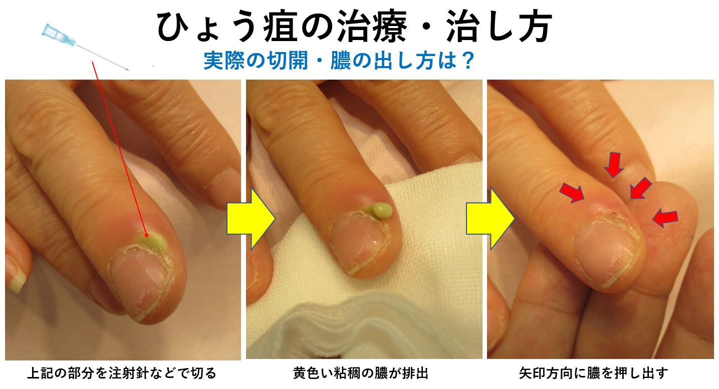 原因と危険因子