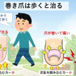 陥入爪と巻き爪の違い・見分け方｜大田区大森の大木皮膚科