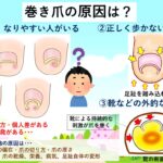 陥入爪と巻き爪の違い・見分け方｜大田区大森の大木皮膚科