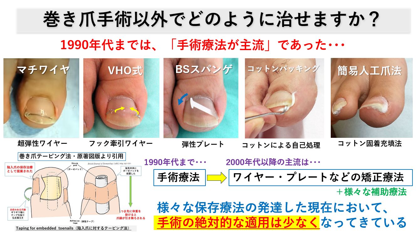 爪 基礎から臨床まで 改訂第2版 | 東 禹彦 |本 | 通販 | Amazon