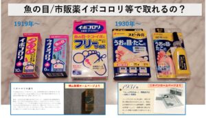 魚の目/市販薬イボコロリ・おすすめの取り方｜大田区大森大木皮膚科